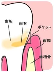 診療台のそばで口腔内の状態を説明する歯科医師と患者